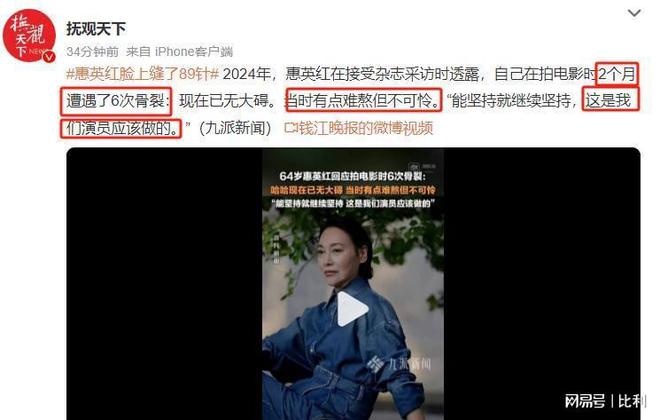 九游娛樂NineGame：臉上縫89針2個(gè)月骨裂6次惠英紅的敬業(yè)打了多少流量明星的臉(圖5)