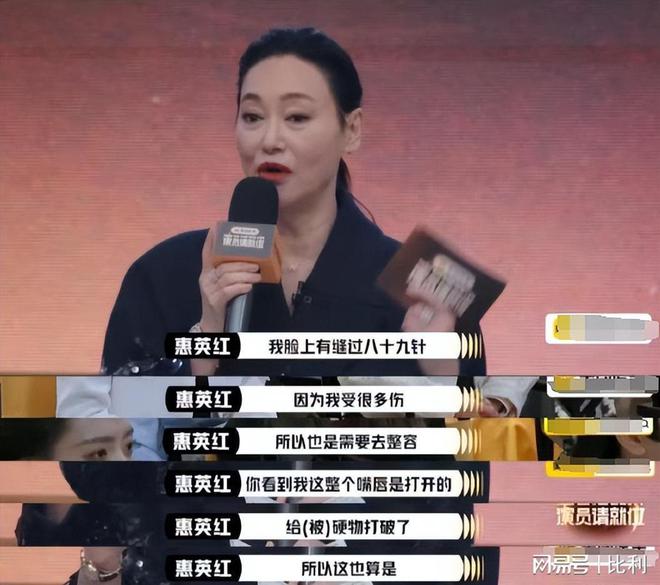 九游娛樂NineGame：臉上縫89針2個(gè)月骨裂6次惠英紅的敬業(yè)打了多少流量明星的臉(圖4)